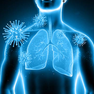 Molecular Testing for Respiratory tract Infection for clinical management